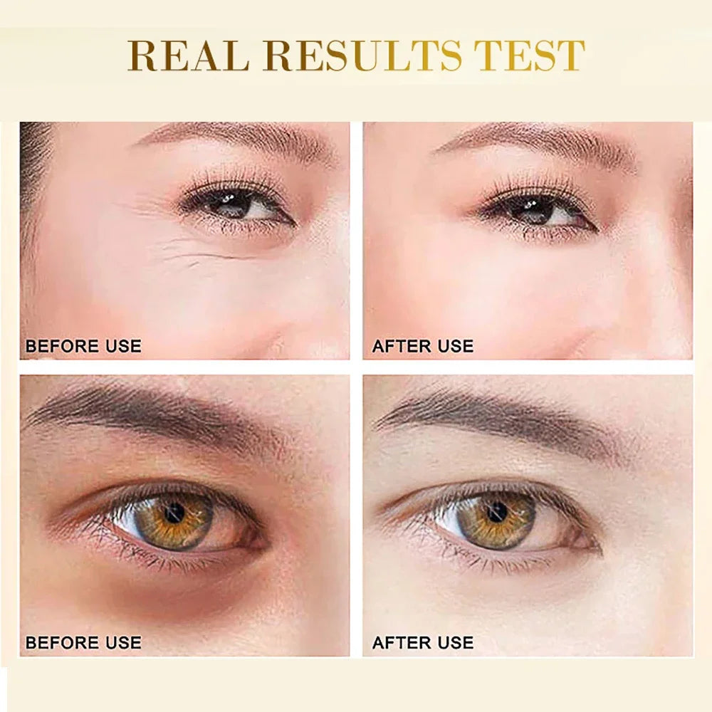 Skincare Products 24K Gold Hyaluronic Acid Eye Mask Remove Dark Eye Circles Collagen Eye Patches Korean Face Care Product | Sorpresa